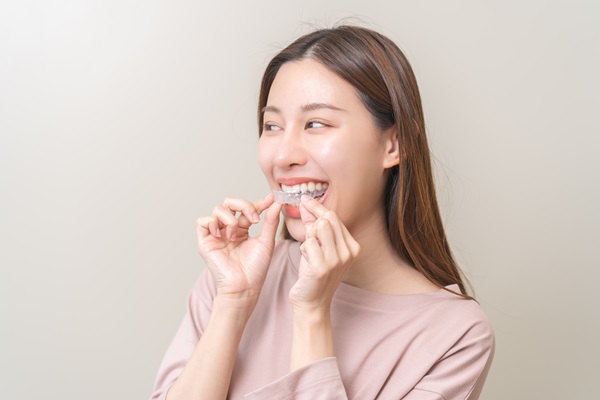 What Are Invisalign Clear Aligners?